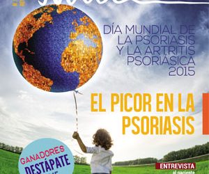 El picor en la psoriasis y psoriasis en uñas, en la revista de otoño