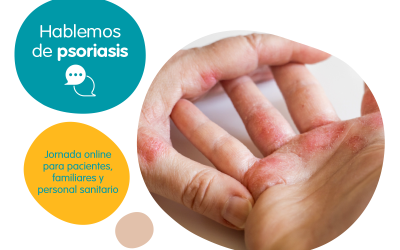 Hablemos de Psoriasis: jornada online para pacientes y familiares