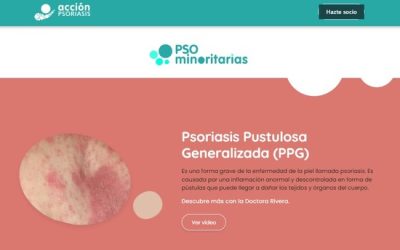 ¿Tienes psoriasis pustulosa generalizada? Infórmate en nuestra nueva web