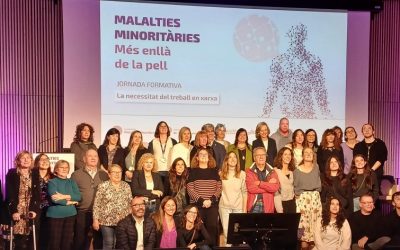 La psoriasis pustulosa, protagonista de la jornada Enfermedades Minoritarias