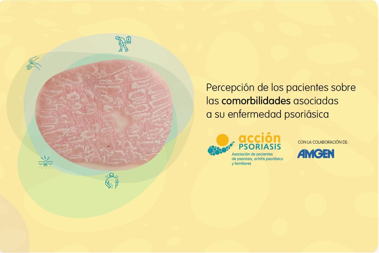comorbilidades Portada del informe con una placa de psoriasis rodeada por círculos